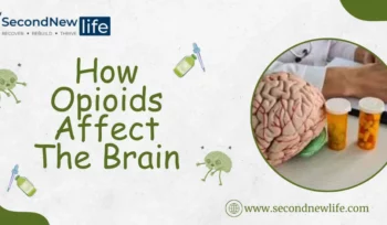 How Opioids Affect The Brain