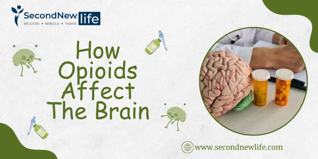 How Opioids Affect The Brain