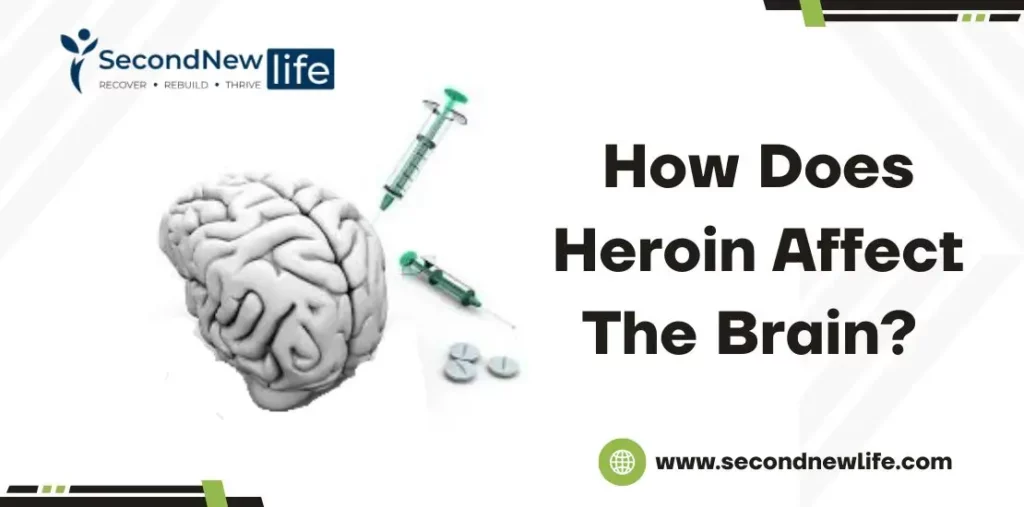 How Does Heroin Affect The Brain? Understanding Its Impact on Mental Health