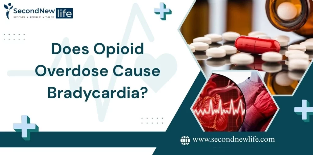 Does Opioid Overdose Cause Bradycardia? Risks of Slow Heart Rate & Recovery Tips